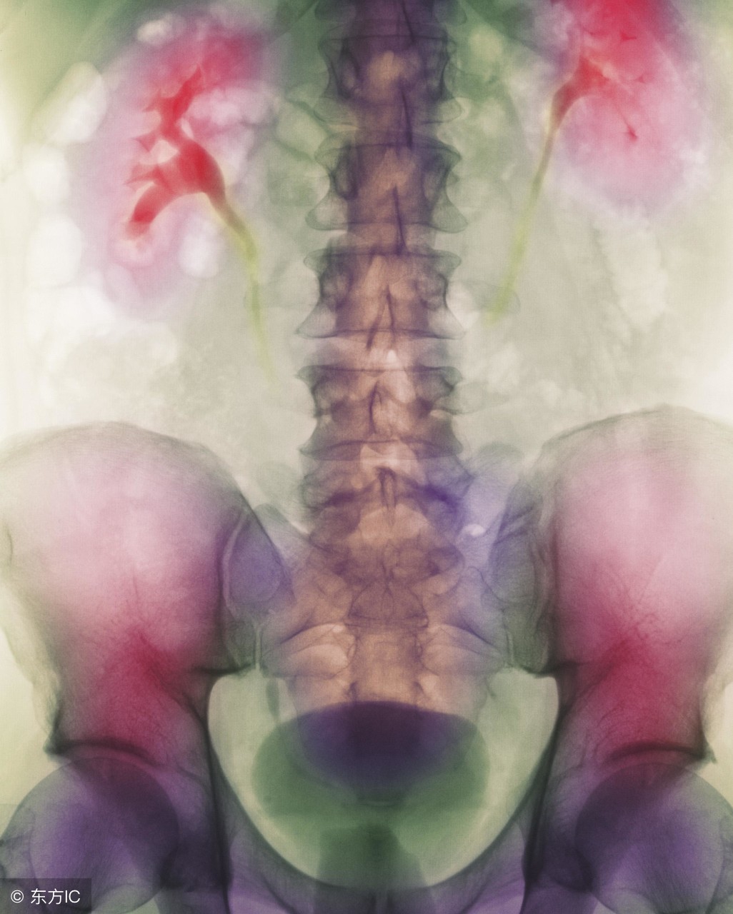 尿结石的症状有哪些初期,尿结石是什么症状表现