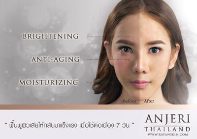 ray面膜的版本 (ray面膜属于什么档次)