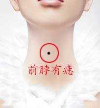 痣相女人脸部痣相图解,女人10处有痣代表富贵痣图解