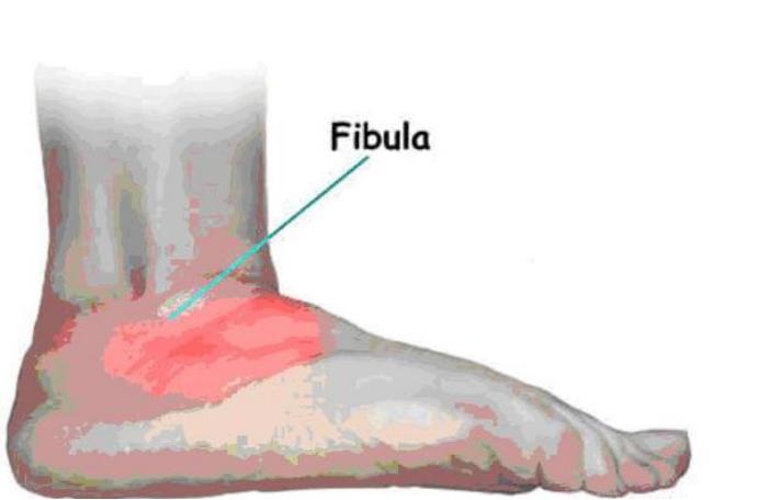 跗骨窦综合征影像诊断视频,跗骨窦损伤针灸治疗