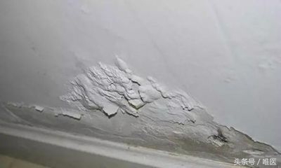 膝盖长期痛怎么办,膝盖痛有什么好方法治疗