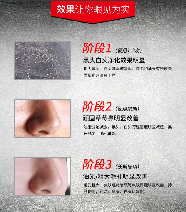 黑头鼻贴正确使用方法男生,鼻贴去黑头男士