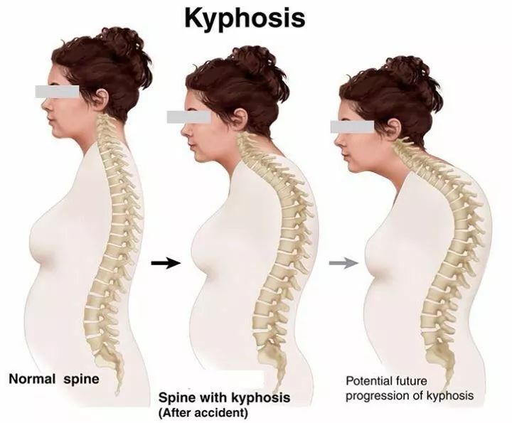 仙女体态训练,仙女肌肉训练