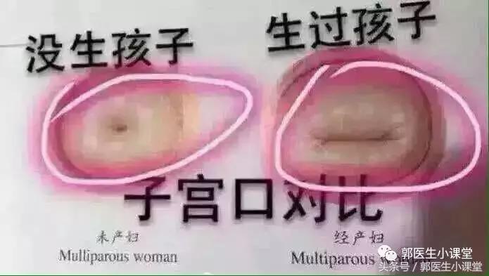 当你发现女朋友打过胎你会怎么办,如何能知道女朋友有没有打过胎