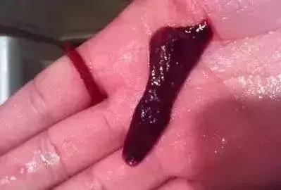 大姨妈来了血色发黑,大姨妈发黑怎样调理最好