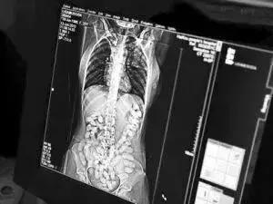 可笑又可怕，为了运毒，他们连小丁丁都不放过