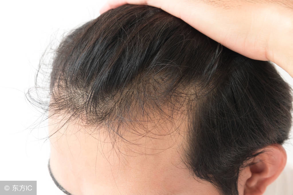 怎么判断男士衰老,如何测试男人是什么体质