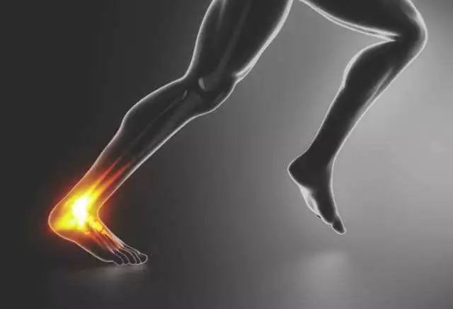 跟腱炎的康复锻炼方法,跟腱炎最好的缓解方法