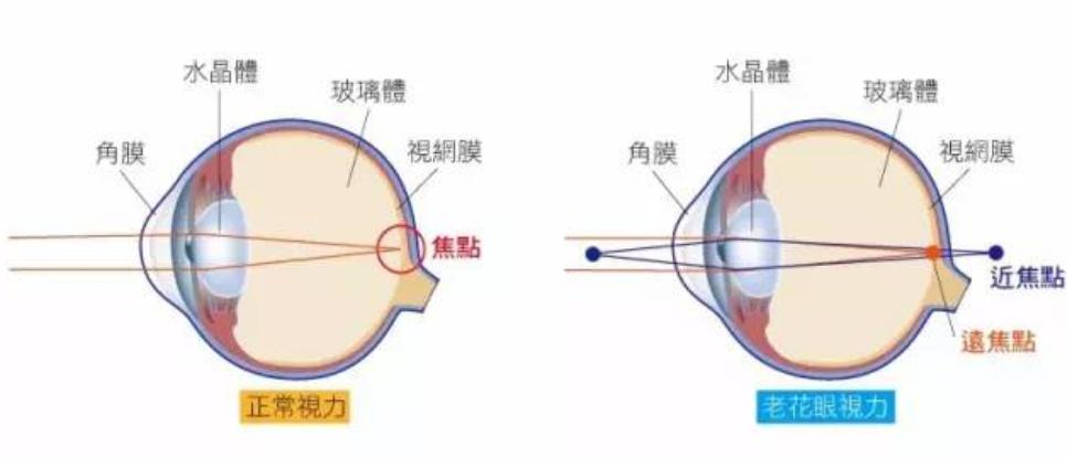 父亲节给爸爸泡一杯茶,老花眼喝枸杞子菊花