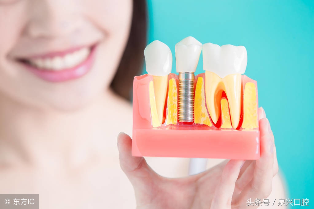 年轻人缺牙是选择种牙还是矫正牙,缺牙选择种牙还是戴牙套呢