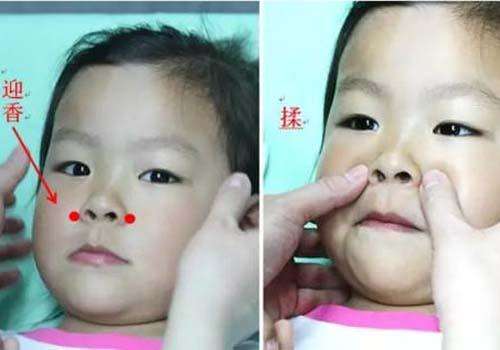 孩子感冒鼻塞不通气用打针吗,宝宝鼻塞不吃药小妙招