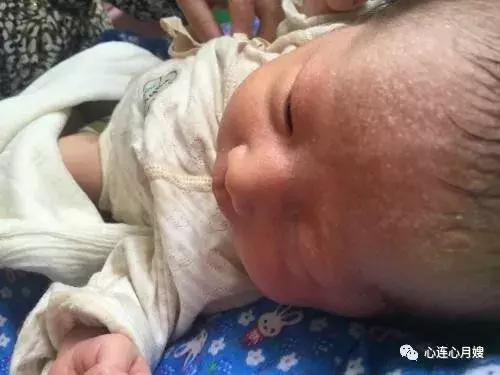 宝宝到底能不能用痱子粉,为什么宝宝不建议用痱子粉