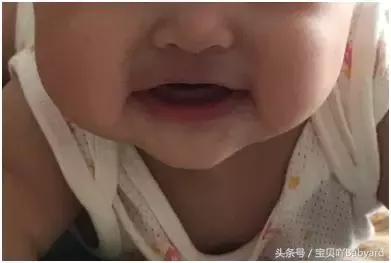 婴儿大量吐奶呈喷射是什么原因,宝宝吐奶喷射状是怎么回事正常吗