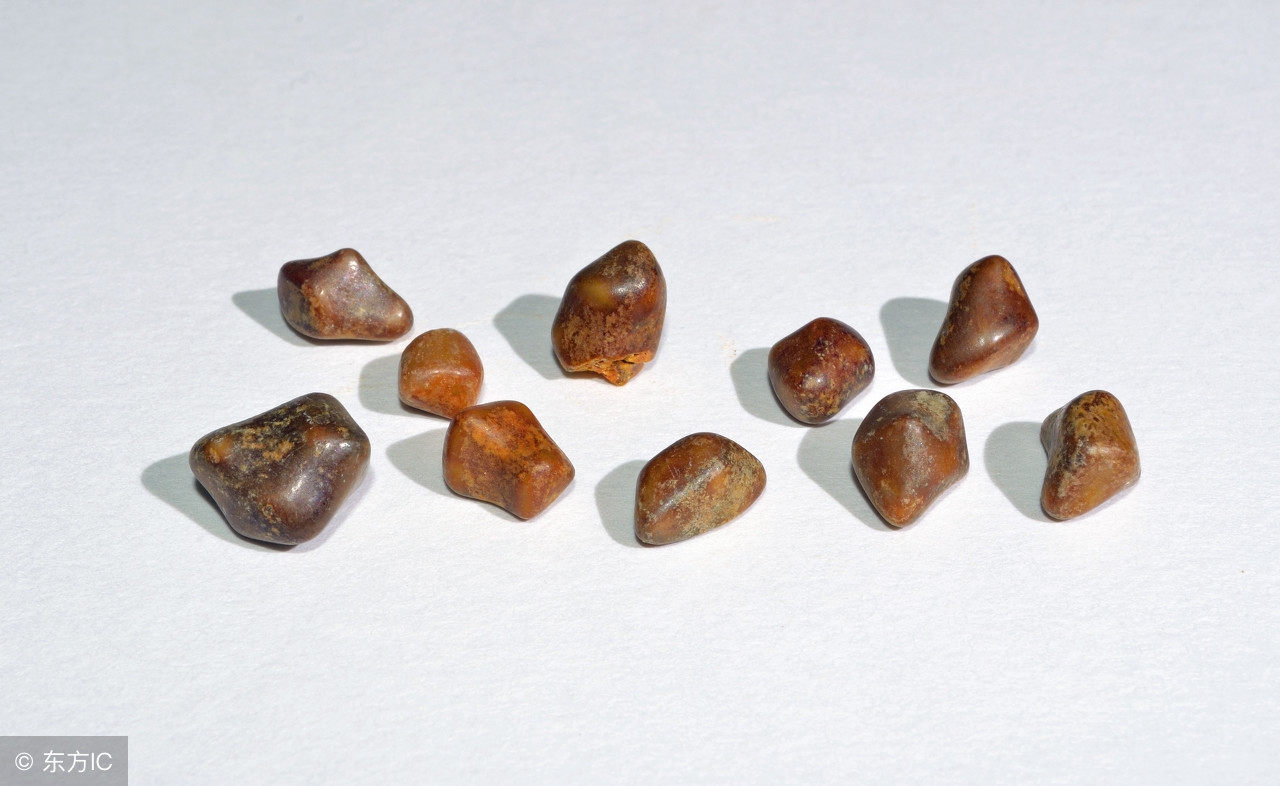 胆结石黄豆大小最佳治疗方法,胆结石的中药治疗方法有哪些