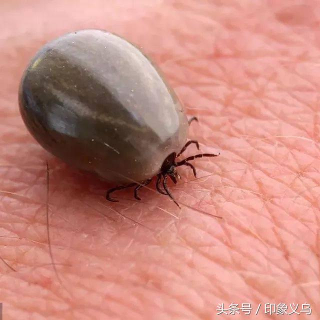 小孩被毒蜘蛛咬伤,小男孩被蜘蛛咬伤了