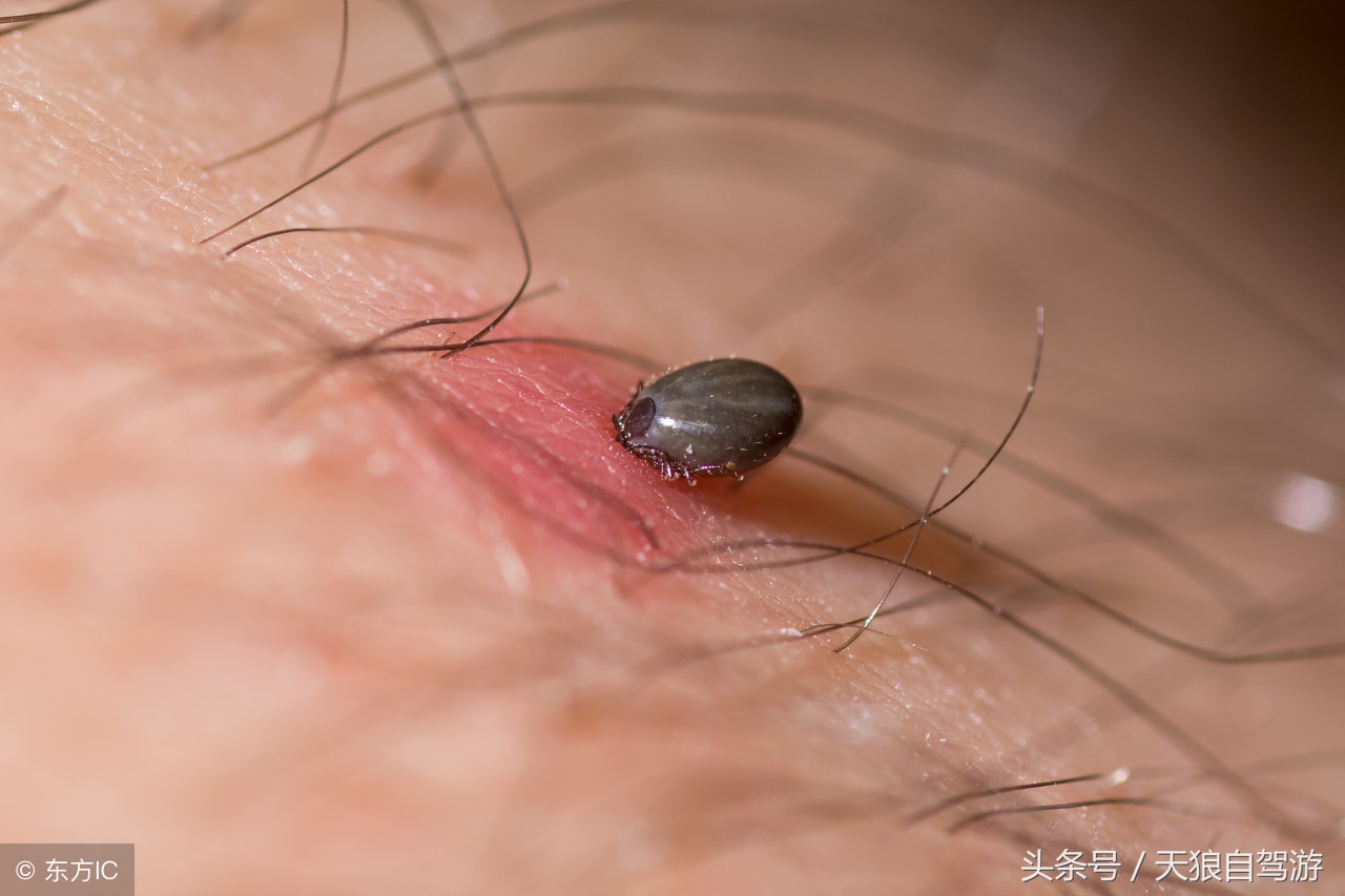 蛇虫叮咬怎么去除,避免蛇虫咬伤的安全措施