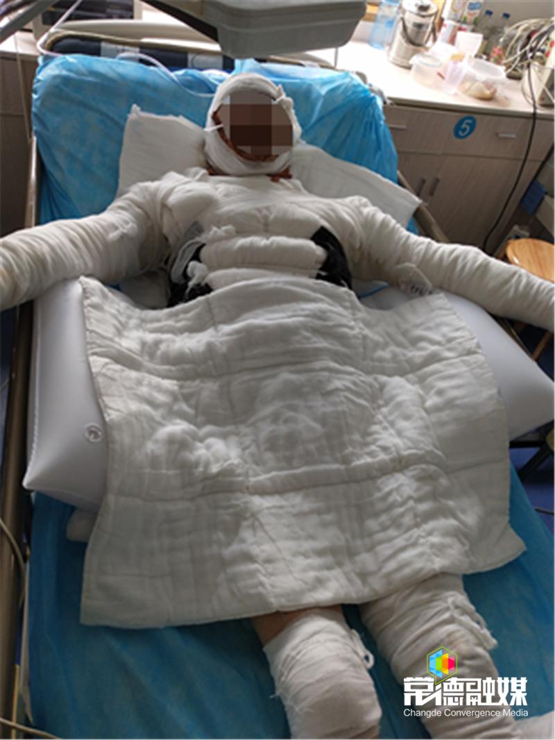 一家7人端午聚会5人烧伤独生女计穷力竭盼帮忙