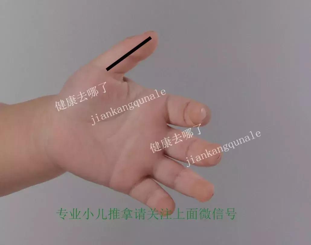 小儿睡觉易醒推拿哪些穴位,小儿睡眠障碍症怎么治疗