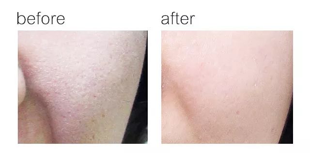 女人到中年的油腻感,怎样避免成为中年油腻女