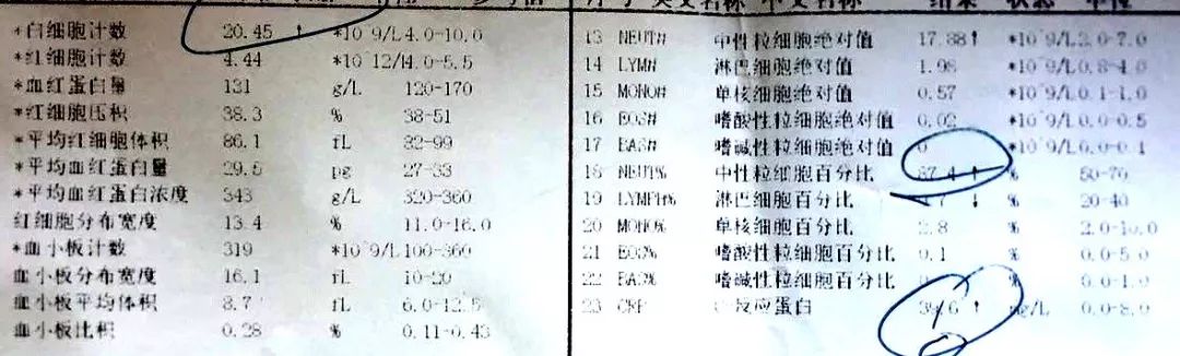 孩子发烧查血能确诊是甲流吗,发烧查血常规是看细菌还是病毒