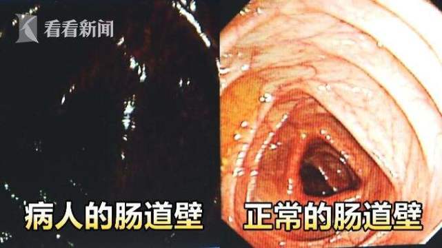 芦荟真的有毒吗,芦荟是二级致癌物么