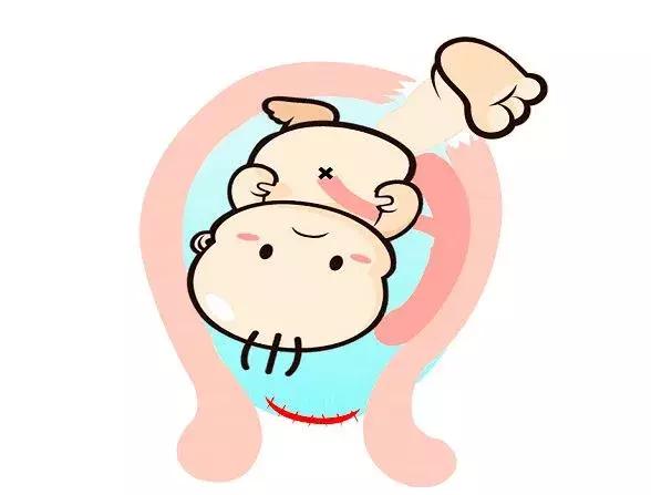 大姨妈不正常，你的子宫内可能多了个“小房间”