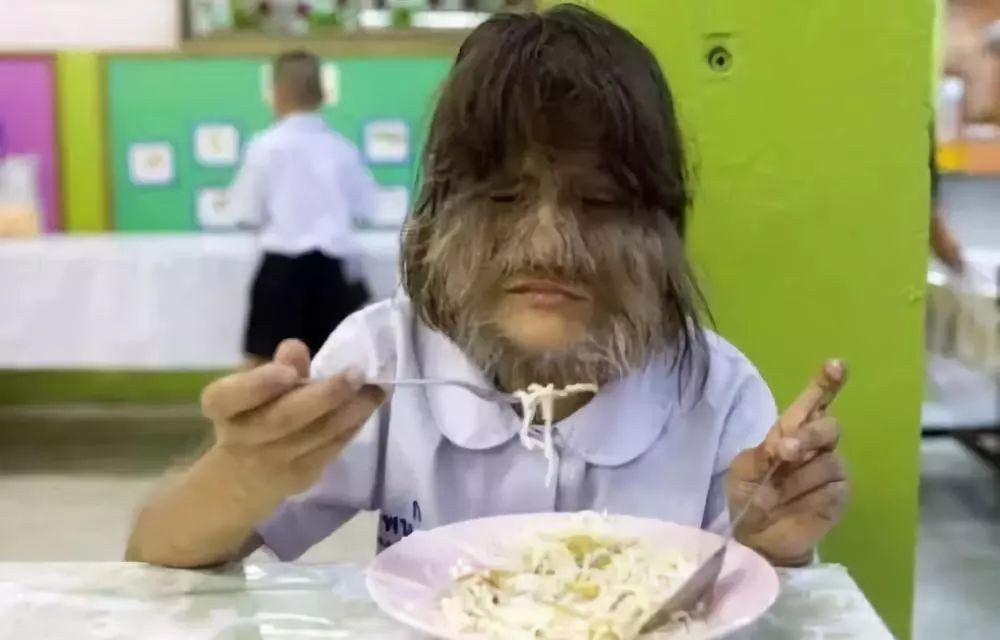 科普脱发是病是不健康的,科普各种脱毛