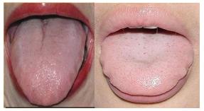 肾阴虚和肾阳虚都有哪些表现,肾阴虚和肾阳虚的区别怎么补