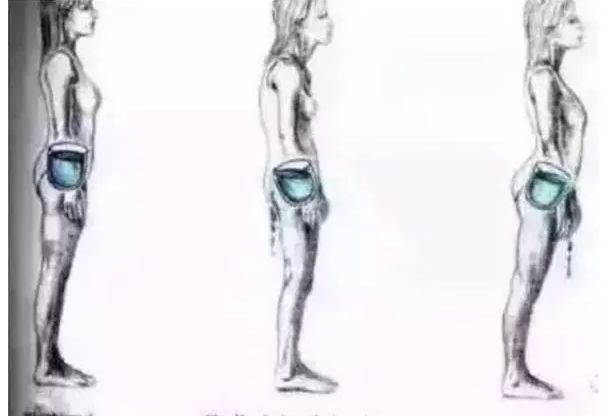 如何判断骨盆后倾还是骨盆前倾,骨盆前倾的日常原因