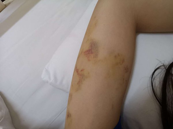 态度不好的医生被暴力殴打,莆田系医院老总打架