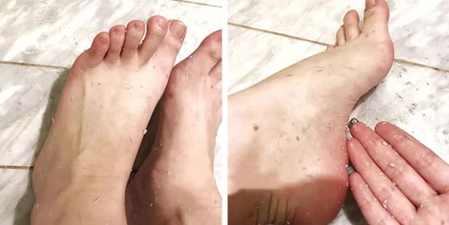 擦掉一张皮，双脚换皮术！死皮、老茧一喷就没，15秒还原嫩白玉足