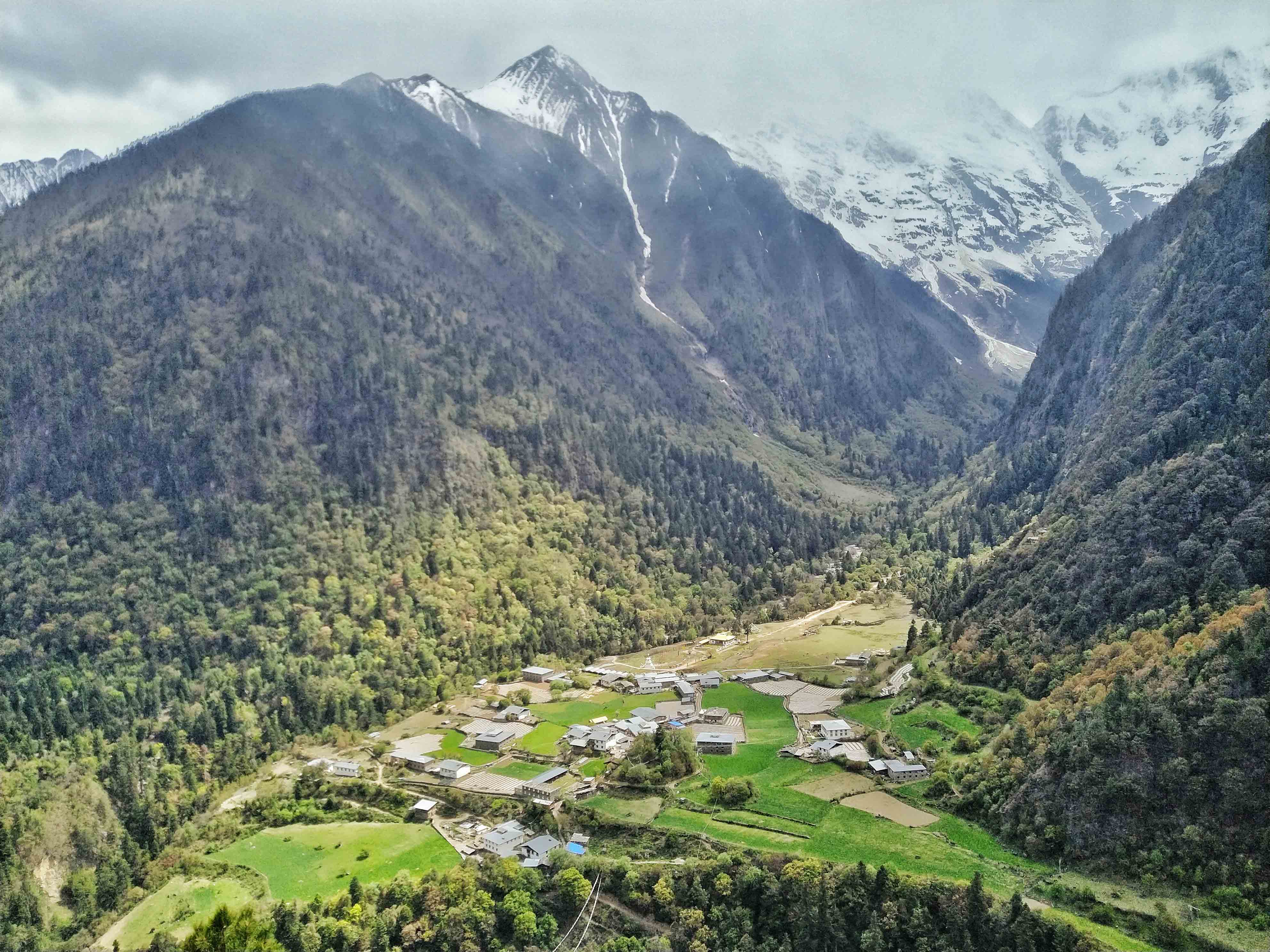 强迫症治疗一次需要多少钱,强迫症治疗一年费用多少