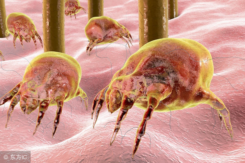 头皮上有螨虫用盐一招搞定,头皮痒除螨虫最快方法