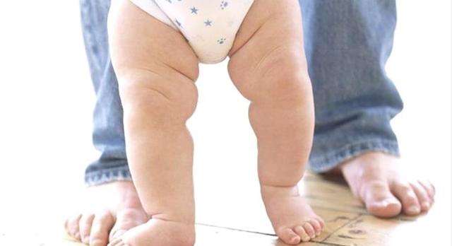 小孩臀纹不对称跛行,宝宝腿纹对称臀纹不对称做什么操
