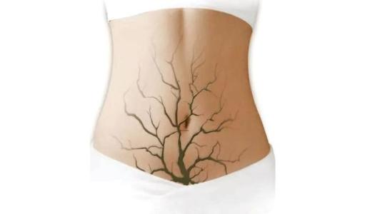 女人妇科炎症有什么忌口,妇科炎症不能吃辣的食物吗