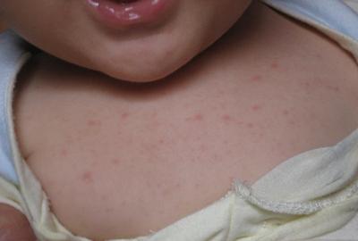 哪款婴儿祛痱爽身露好用,除痱子爽身露测评