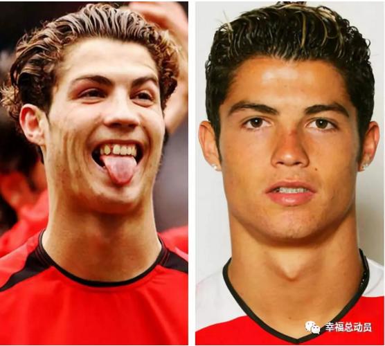 c罗整容了吗,c罗整牙颜值变化
