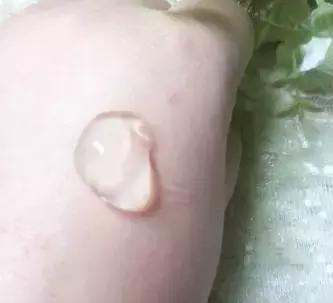 亲试十大祛痘药,亲测各类祛痘印护肤品