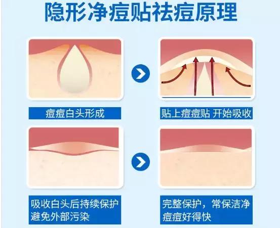 亲试十大祛痘药,亲测各类祛痘印护肤品