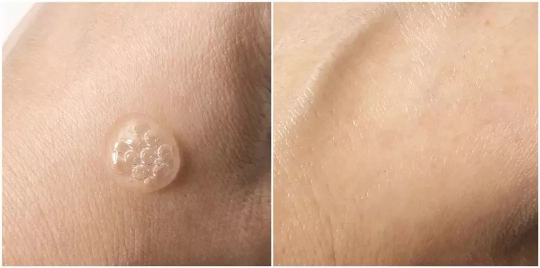 润百颜面膜的功效与作用,为啥润百颜是国货还这么贵