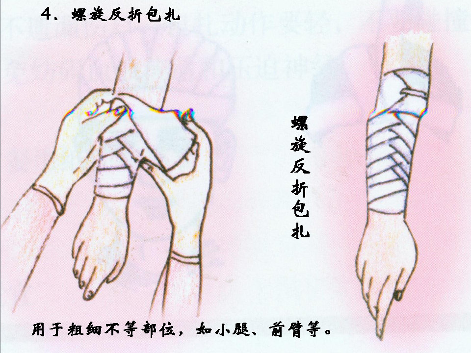 换药和拆线操作流程视频,换药拆线操作视频