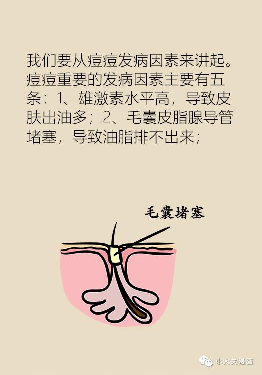 协和医生说：几块钱就能买到的祛痘神药，绝大多数人都不知道！