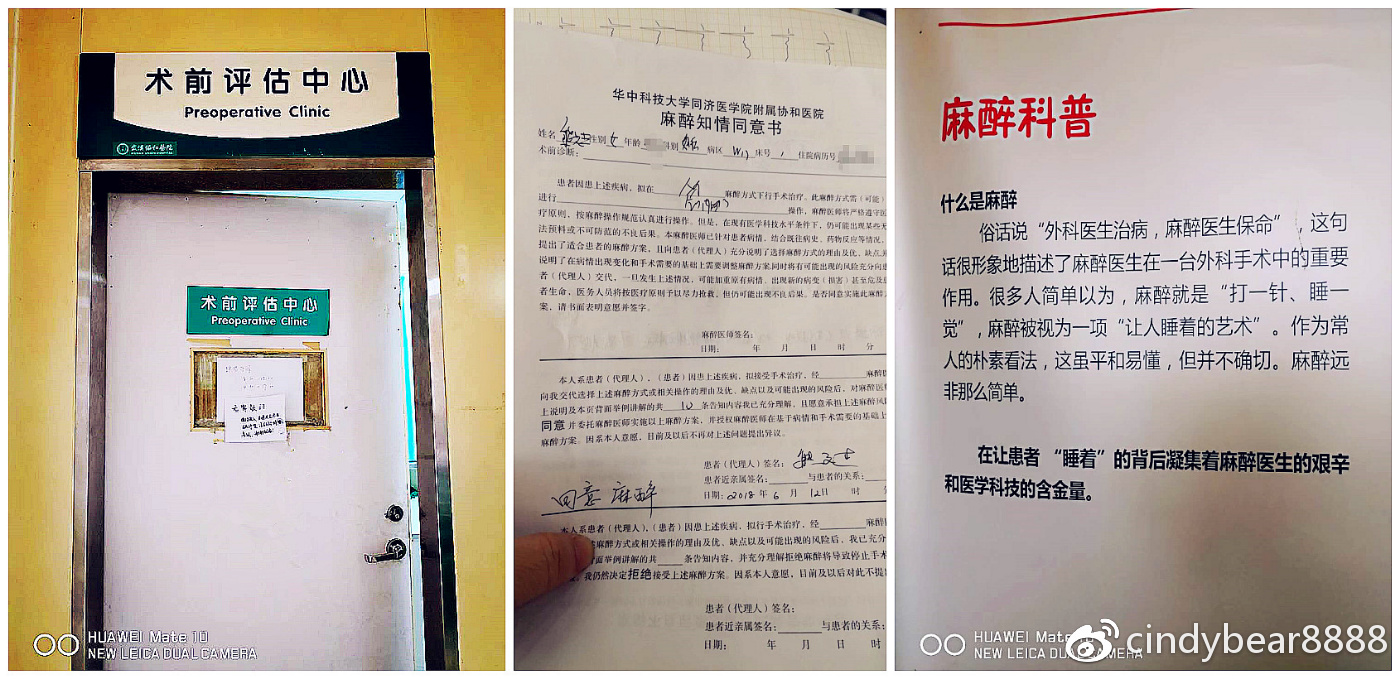 动画演示子宫全切术,动画演示切子宫手术