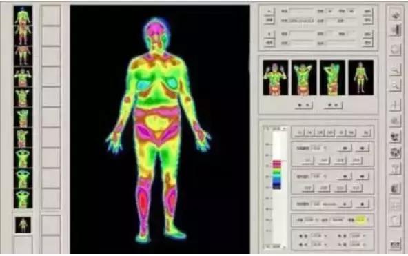 这个仪器好神奇：红黄蓝绿，扫描后身体病症成像仿佛是气象云图