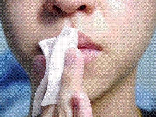 唇周有一圈黑,唇边一圈黑是什么原因