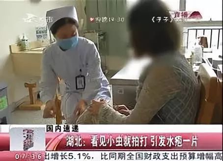 小心“新型艾滋病”，虫子就能传播