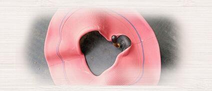 家里有蚂蚁怎么办如何快速除蚁,厨房和卫生间有蚂蚁是怎么回事