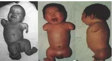 我不是药神进口假药,我不是药神的进口药叫什么名字