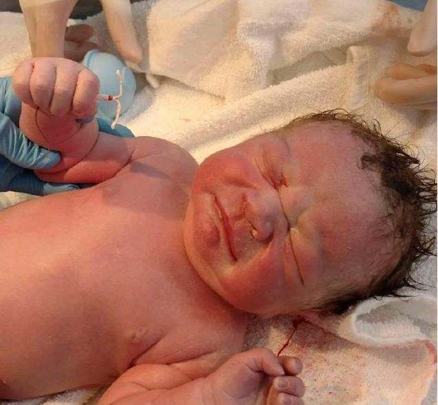 带环怀孕了该怎么办能要吗,带环怀孕了要怎么处理