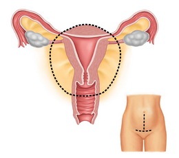 宫颈糜烂要用药吗?治好了还要做宫颈癌筛查吗?